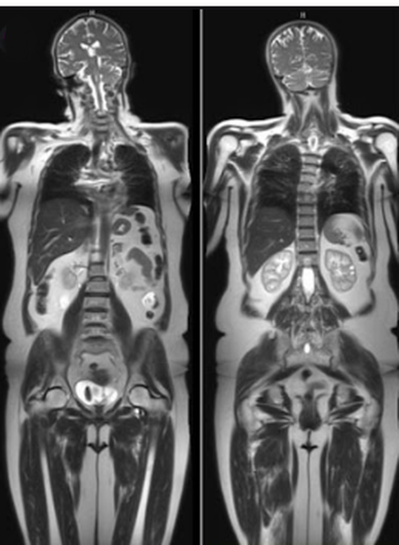 МР-изображение тела человека