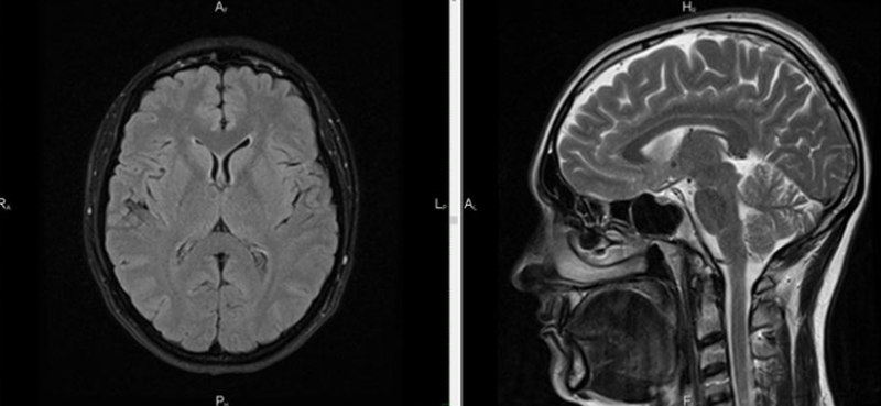 Снимок МРТ головы