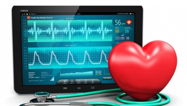  ЭКГ – основной способ оценки проводящей функции сердца