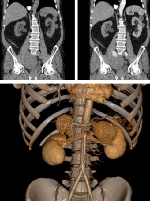  Примеры изображений: органы мочевыделительной системы
