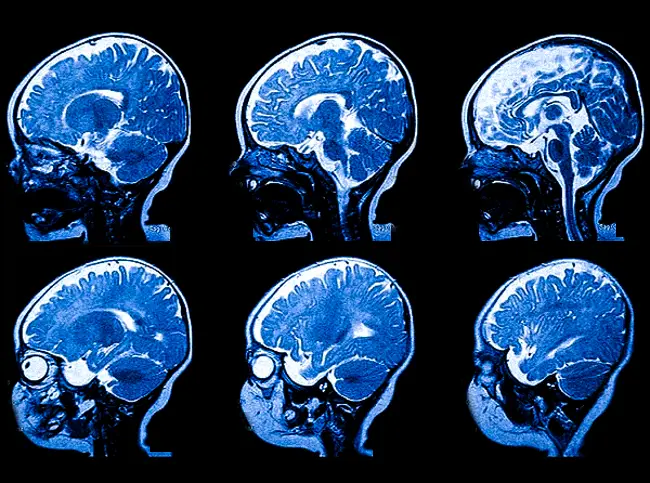 Серия послойных изображений головного мозга ребенка