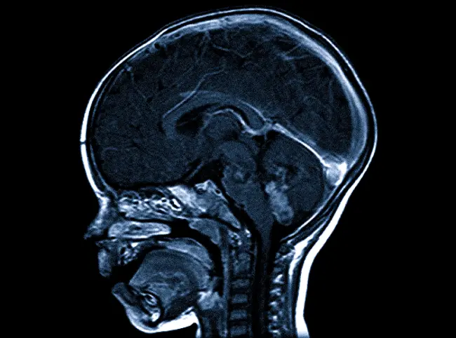 Как делают МРТ головного мозга детям