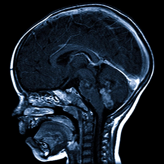 Как делают МРТ головного мозга детям