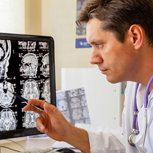 Как подготовиться к МРТ головного мозга?