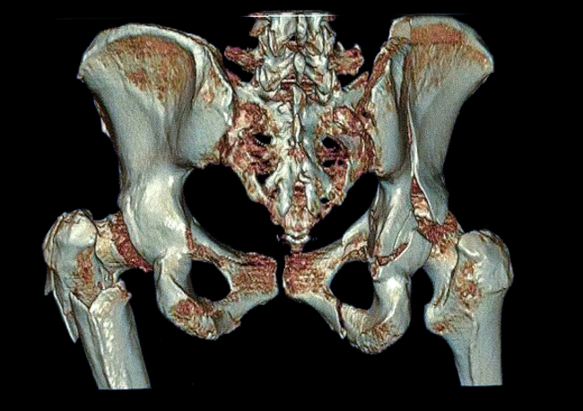 3D-модель костей таза