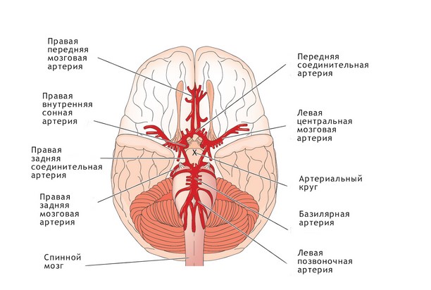 КТ ангиография интракраниальных артерий