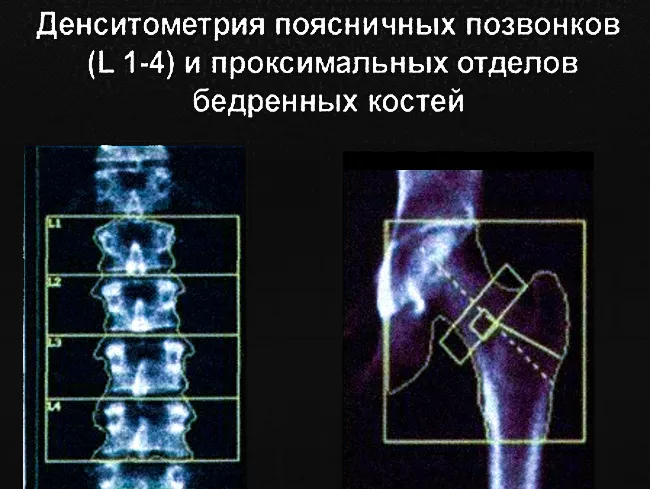 Компьютерный томограф