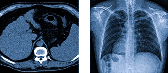 Компьютерная томография и рентген