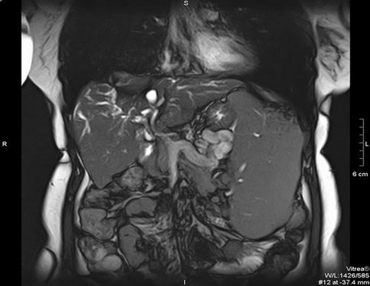 Органы брюшной полости на МР-скане
