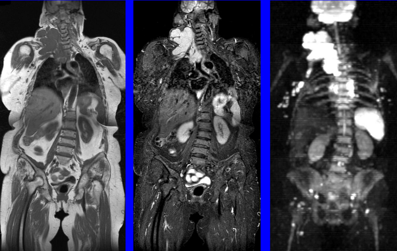 МР-снимки тела пациента в разных режимах