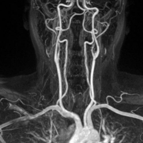 МРТ головы и шеи что показывает