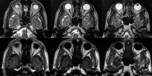 Серия послойных изображений, полученных в результате МРТ головы