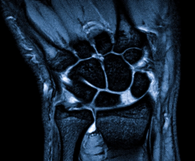 Магнитно-резонансная томограмма кисти