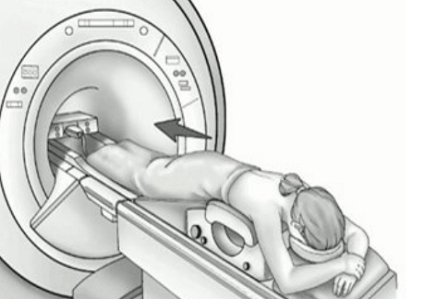 Схематичное изображение укладки пациентки при выполнении томографии груди