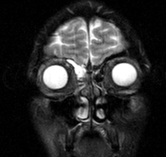 МР-сканирование синусов