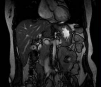 Визуализация органов билиарного тракта на МР-скане