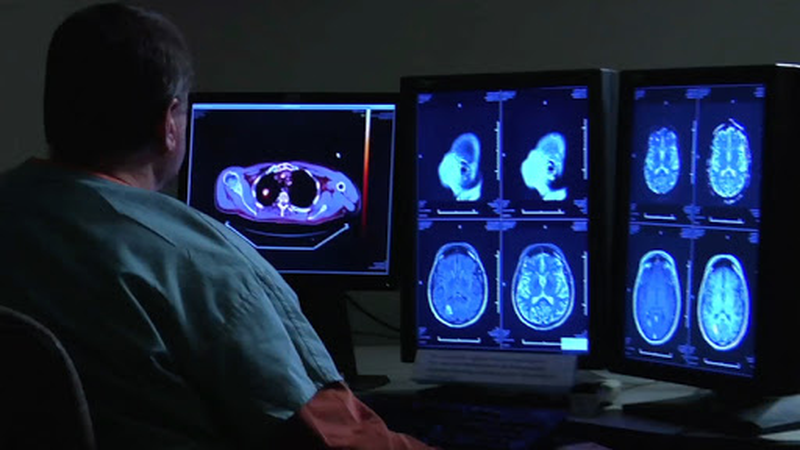 Снимок головного мозга на мониторе при МРТ с контрастом