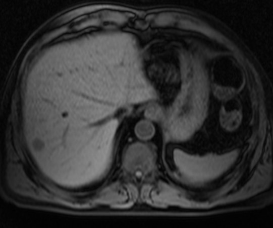 МР-изображение внутренних органов