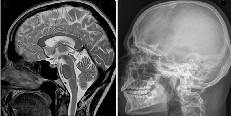 МРТ и рентген головы