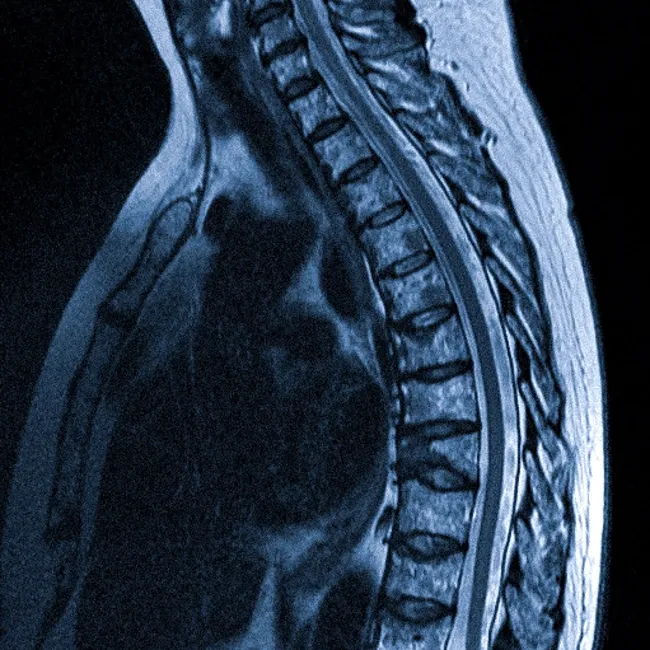 Сколько длится МРТ грудного отдела позвоночника