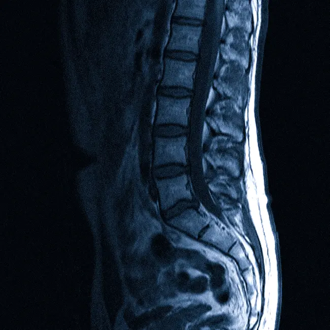 МРТ пояснично-крестцового отдела