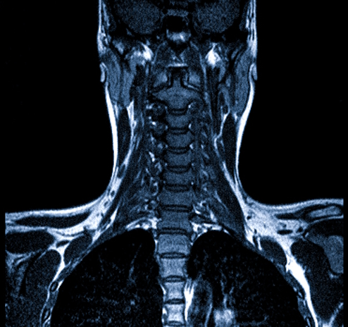 Магнитно-резонансное сканирование шейного отдела позвоночника