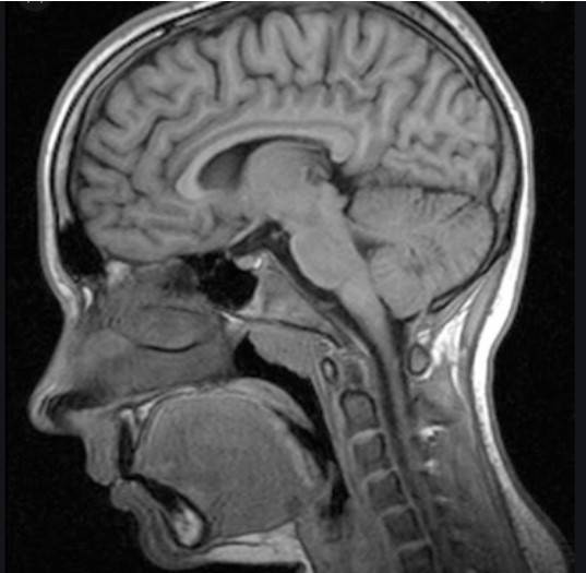 МР-изображение  головы